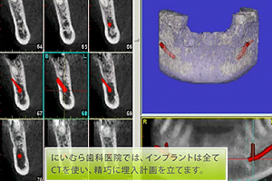 施術プラン